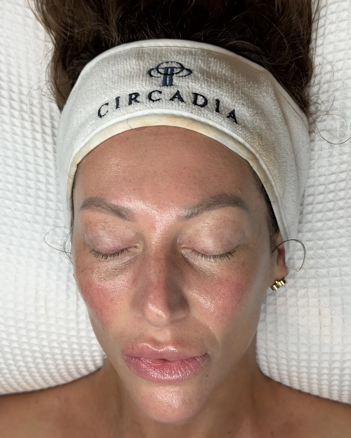Skin glowing after a restorative facial